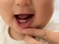 Pierwszy ząbek dziecka: Kiedy? Jakie objawy? Jak ulżyć?