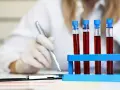 Laborantka w białej rękawiczce analizuje próbki krwi, badając poziom protrombiny.