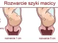 1 cm rozwarcia: Ile jeszcze do porodu? Sprawdź!