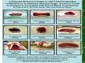 Wizualne oszacowanie krwawienia po porodzie: podkładka higieniczna 30ml, wacik 100ml, wacik 60ml, podkład poporodowy 250ml, duży wacik 350ml, plama na podłodze 1500ml, łóżko 1000ml, podłoga 2000ml, duża miska 500ml.