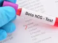 Rękawiczka w niebieskiej rękawiczce trzyma probówkę z krwią do testu Beta hCG. Na formularzu zaznaczono "Beta HCG" w sekcji "Hormone".