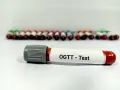 Probówki z krwią do badania OGTT - test obciążenia glukozą. W tle rząd innych próbek.