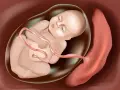 Dziecko w łonie matki, otoczone płynem owodniowym, z pępowiną połączoną z łożyskiem.