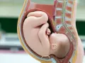 Model anatomiczny pokazuje ułożenie dziecka w brzuchu. Maluch zwinięty w kłębek, gotowy do przyjścia na świat.