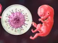Powiększony wirus cytomegalii (CMV) obok płodu, sugerujący potencjalne objawy CMV u nienarodzonego dziecka.