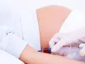 Pobieranie krwi do badań w 15 tygodniu ciąży. Lekarz w rękawiczkach pobiera krew strzykawką od ciężarnej.