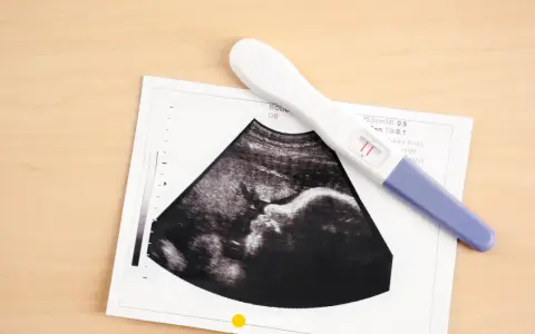 USG pokazuje pęcherzyk ciążowy, a obok leży pozytywny test ciążowy.