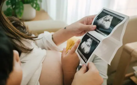 Rodzice oglądają USG. Na zdjęciu widać zarodek, który ma już 11 tydzień ciąży.
