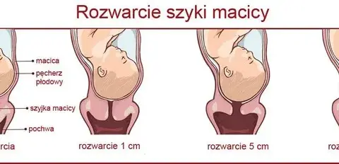 1 cm rozwarcia: Ile jeszcze do porodu? Sprawdź!