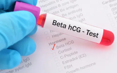 Rękawiczka w niebieskiej rękawiczce trzyma probówkę z krwią do testu Beta hCG. Na formularzu zaznaczono "Beta HCG" w sekcji "Hormone".