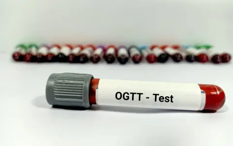 Probówki z krwią do badania OGTT - test obciążenia glukozą. W tle rząd innych próbek.