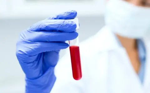 Naukowczyni w niebieskiej rękawiczce trzyma probówkę z krwią. Analiza d-dimerów pomoże ustalić, jak obniżyć ich poziom.