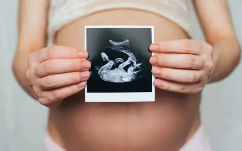 Ciężarna kobieta trzyma zdjęcie USG, na którym widać dziecko. Widać też łożysko na przedniej ścianie.