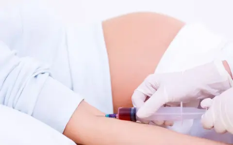 Pobieranie krwi do badań w 15 tygodniu ciąży. Lekarz w rękawiczkach pobiera krew strzykawką od ciężarnej.