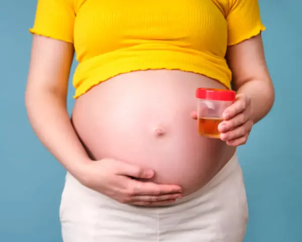 Kobieta w ciąży trzyma pojemnik z próbką moczu, badanie na obecność ketonów w moczu w ciąży.