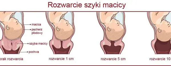 1 cm rozwarcia: Ile jeszcze do porodu? Sprawdź!