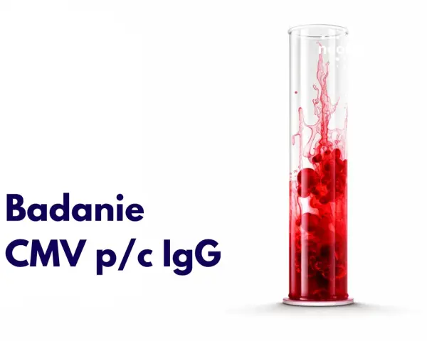 Badanie CMV p/c IgG: wynik dodatni w ciąży. Czerwona substancja w probówce symbolizuje badanie.