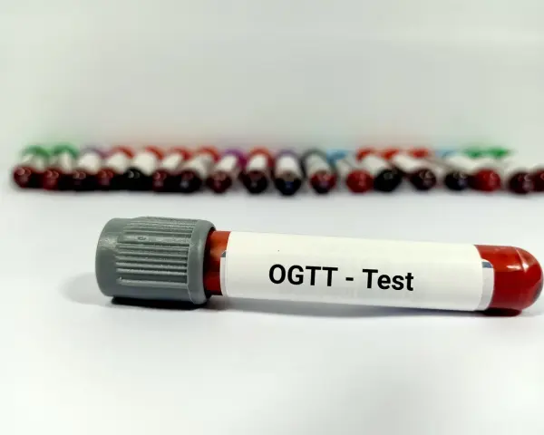 Probówki z krwią do badania OGTT - test obciążenia glukozą. W tle rząd innych próbek.