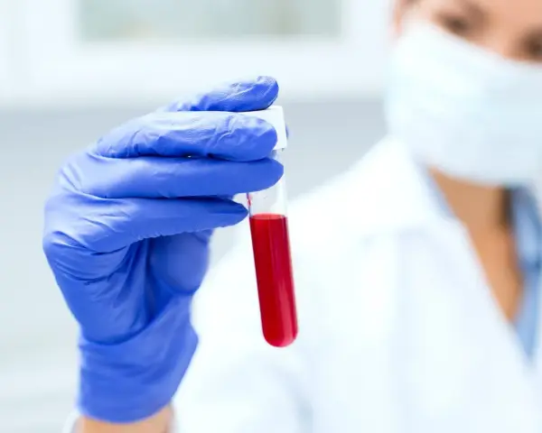 Naukowczyni w niebieskiej rękawiczce trzyma probówkę z krwią. Analiza d-dimerów pomoże ustalić, jak obniżyć ich poziom.