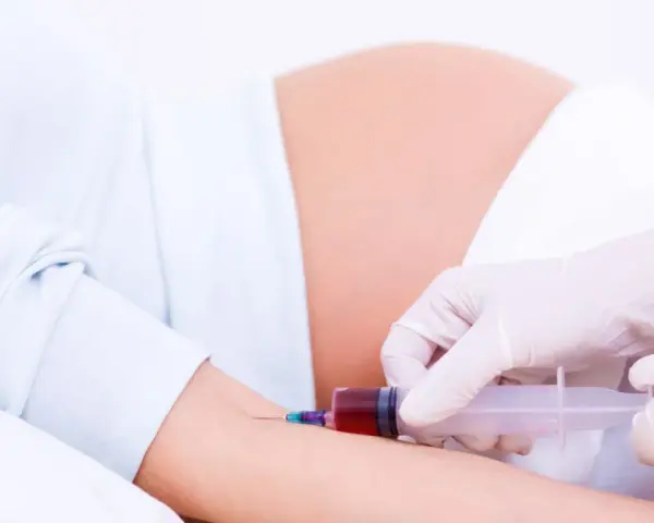 Pobieranie krwi do badań w 15 tygodniu ciąży. Lekarz w rękawiczkach pobiera krew strzykawką od ciężarnej.