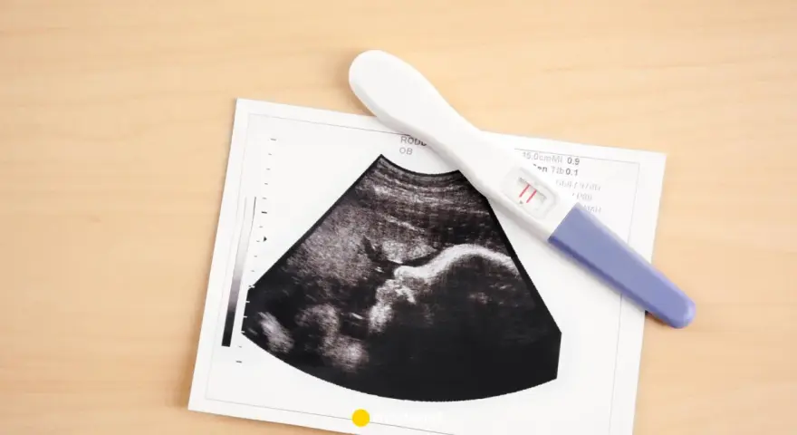 USG pokazuje pęcherzyk ciążowy, a obok leży pozytywny test ciążowy.