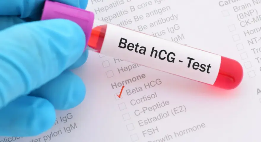 Rękawiczka w niebieskiej rękawiczce trzyma probówkę z krwią do testu Beta hCG. Na formularzu zaznaczono "Beta HCG" w sekcji "Hormone".