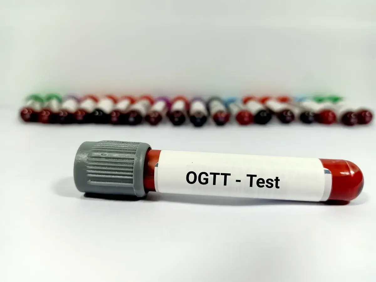 Probówki z krwią do badania OGTT - test obciążenia glukozą. W tle rząd innych próbek.